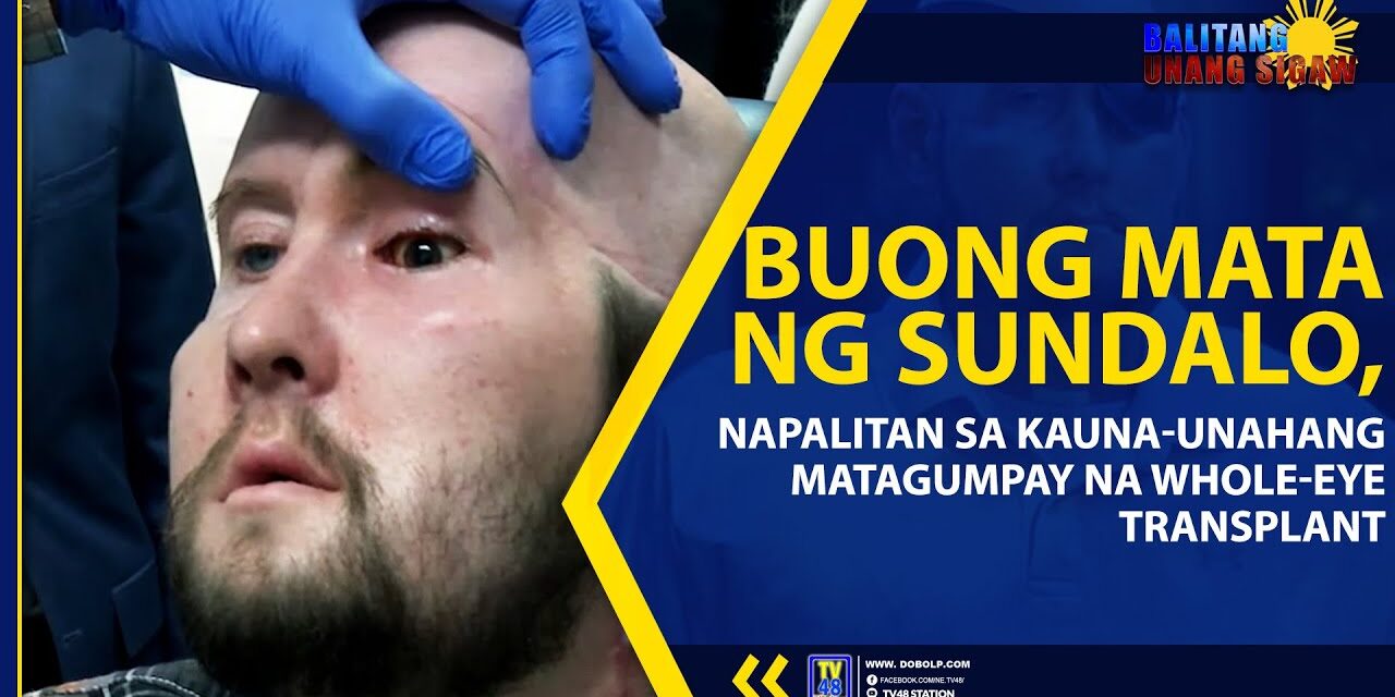BUONG MATA NG SUNDALO, NAPALITAN SA KAUNA-UNAHANG MATAGUMPAY NA WHOLE-EYE TRANSPLANT