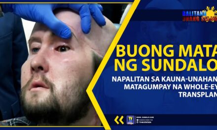 BUONG MATA NG SUNDALO, NAPALITAN SA KAUNA-UNAHANG MATAGUMPAY NA WHOLE-EYE TRANSPLANT