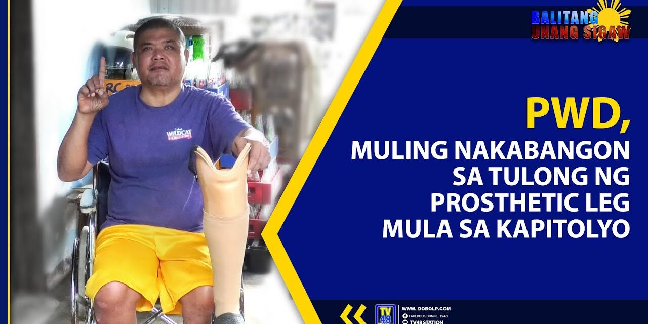 PWD, MULING NAKABANGON SA TULONG NG PROSTHETIC LEG MULA SA KAPITOLYO