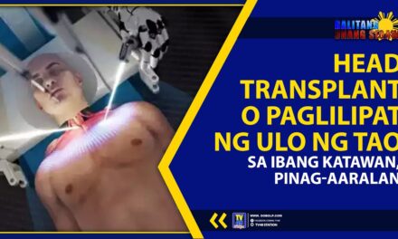 HEAD TRANSPLANT O PAGLILIPAT NG ULO NG TAO SA IBANG KATAWAN, PINAG-AARALAN