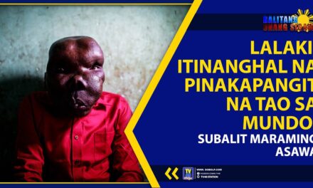 LALAKI, ITINANGHAL NA PINAKAPANGIT NA TAO SA MUNDO; SUBALIT MARAMING ASAWA