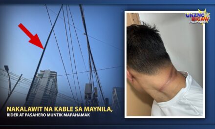 NAKALAWIT NA KABLE, MUNTIK IKAMATAY NG RIDER AT PASAHERO SA MAYNILA